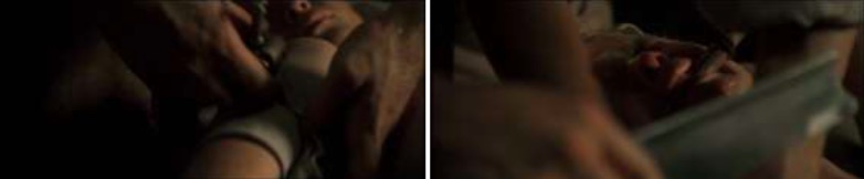 Master and Commander amputación